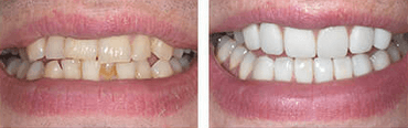 Cosmetic Dentistry at the Perfect Smile Studios