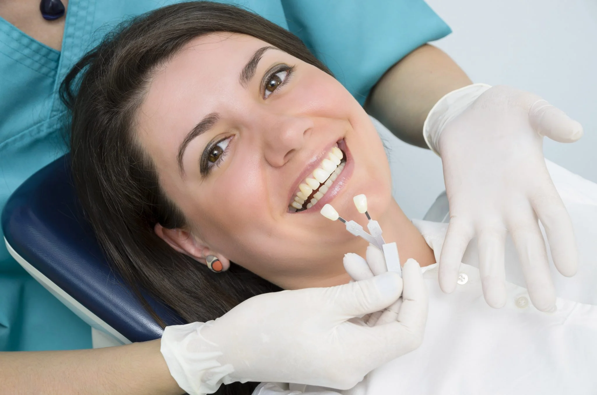 Dental veneers to create your perfect smile
