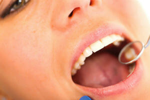 what your teeth say about your health