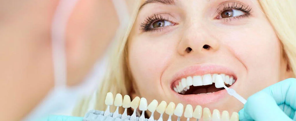 Cheap Veneers UK: Can You Really Get Them? | The Perfect Smile