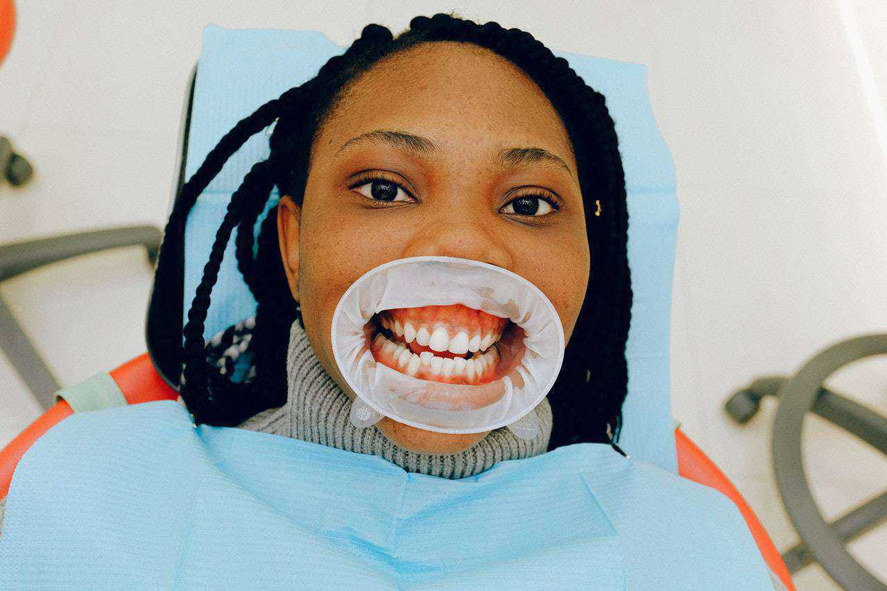 gum disease patient photo