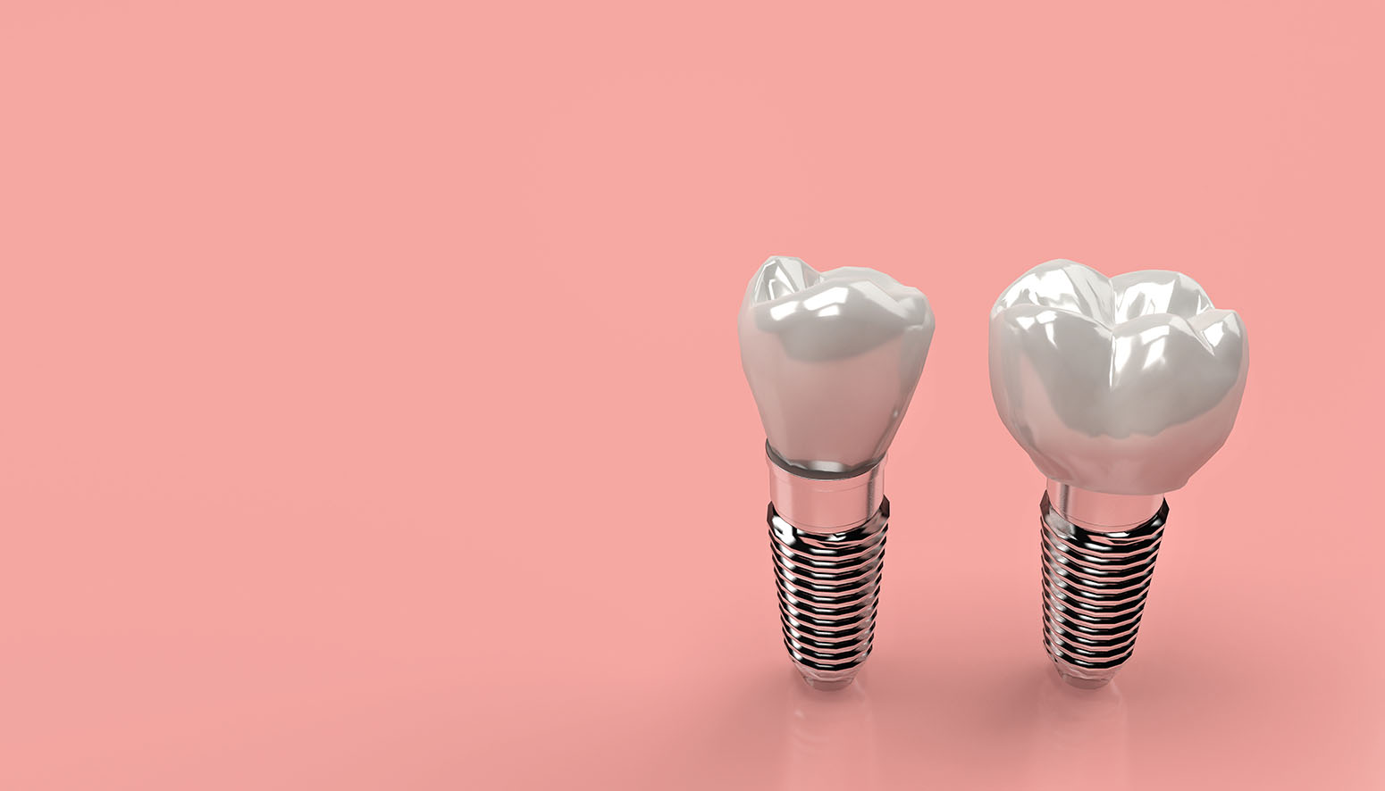 Price of Dental Implants - How Much Do They Cost?